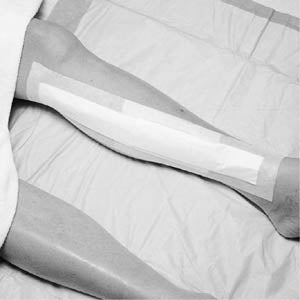 3M MEDIPORE +PAD SOFT CLOTH ADHESIVE WOUND DRESSING 3566